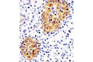 Paraformaldehyde-fixed, paraffin embedded human pancreas tissue, Antigen retrieval by boiling in sodium citrate buffer (pH6. (RAB3B 抗体)
