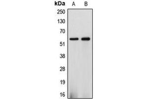 Western blot analysis of Cytochrome P450 2J2 expression in HepG2 (A), A549 (B) whole cell lysates. (CYP2J2 抗体  (Center))
