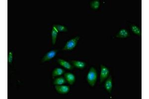 Immunofluorescence (IF) image for anti-Zinc Finger, MYND-Type Containing 11 (ZMYND11) (AA 363-513) antibody (ABIN7176097)