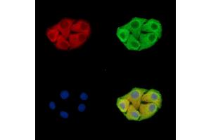 ABIN7096438 and ABIN7100502 staining Hela cells by IF/ICC. (GRAMD1B 抗体)