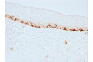 Immunohistochemistry (IHC) image for anti-Melan A (MLANA) antibody (ABIN6939390)