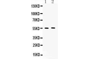 Western blot analysis of MMP11 expression in rat spleen extract ( Lane 1) and MM231 whole cell lysates ( Lane 2).