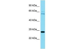 Western Blotting (WB) image for anti-Chromosome 4 Open Reading Frame 43 (C4orf43) (Middle Region) antibody (ABIN2791117) (C4orf43 抗体  (Middle Region))