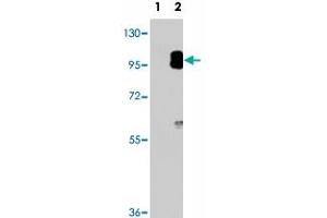 Western blot analysis of PRKG2 (arrow) using PRKG2 polyclonal antibody . (PRKG2 抗体  (C-Term))