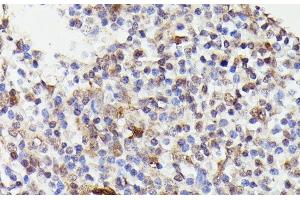 Immunohistochemistry of paraffin-embedded Human tonsil using CDC23 Polyclonal Antibody at dilution of 1:100 (40x lens). (CDC23 抗体)