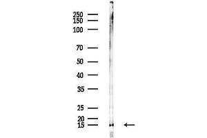 anti-Ribosomal Protein L35a (RPL35A) (N-Term) antibody