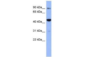 WB Suggested Anti-ZNF569 Antibody Titration:  0.