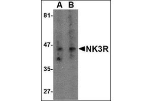 Western blot analysis of NK3R in RAW264. (TACR3 抗体  (Center))