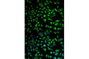 Immunofluorescence analysis of HeLa cells using SPAM1 antibody. (SPAM1 抗体)