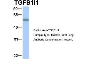 Western Blotting (WB) image for anti-Transforming Growth Factor beta 1 Induced Transcript 1 (TGFB1I1) (Middle Region) antibody (ABIN2777947)