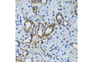 Immunohistochemistry of paraffin-embedded mouse kidney using RPN1 antibody. (RPN1 抗体)