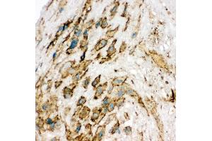 Anti-VEGF Receptor 2 antibody, IHC(F) IHC(F): Human Placenta Tissue (VEGFR2/CD309 抗体  (Middle Region))