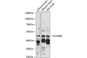 Western blot analysis of extracts of various cell lines, using KCN antibody (ABIN7269483) at 1:1000 dilution. (KCNAB3 抗体  (AA 285-404))