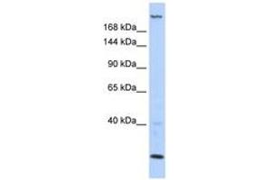 Image no. 1 for anti-Trinucleotide Repeat Containing 6B (TNRC6B) (AA 396-445) antibody (ABIN6743011) (TNRC6B 抗体  (AA 396-445))