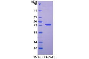 SDS-PAGE analysis of Human APRT Protein. (APRT 蛋白)