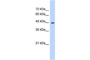 Western Blotting (WB) image for anti-Hydroxyacyl-CoA Dehydrogenase/3-Ketoacyl-CoA Thiolase/enoyl-CoA Hydratase (Trifunctional Protein), beta Subunit (HADHB) antibody (ABIN631070)
