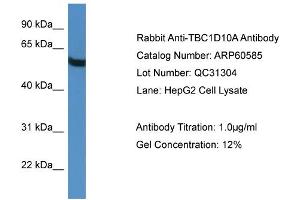 WB Suggested Anti-TBC1D10A  Antibody Titration: 0. (TBC1D10A 抗体  (C-Term))