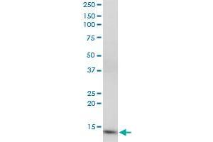 CIDEC monoclonal antibody (M07), clone 2E2. (CIDEC 抗体  (AA 53-141))