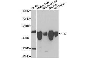 Western blot analysis of extracts of various cell lines, using HPD antibody. (HPD 抗体  (AA 1-393))