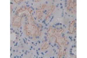 Immunohistochemistry (IHC) image for anti-Intercellular Adhesion Molecule 1 (ICAM1) (AA 26-480) antibody (ABIN1859239)