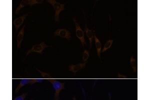 Immunofluorescence analysis of L929 cells using RGS4 Polyclonal Antibody at dilution of 1:100.