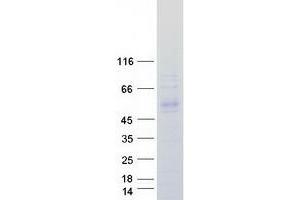 Western Blotting (WB) image for Kelch Domain Containing 1 (KLHDC1) protein (Myc-DYKDDDDK Tag) (ABIN2724301)