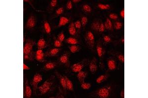 IF analysis of FLI1 using anti-FLI1 antibody (ABIN7599409). (FLI1 抗体  (AA 1-452))
