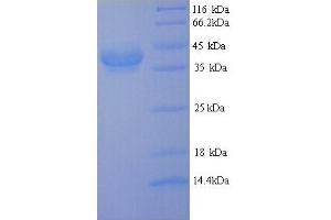 SDS-PAGE (SDS) image for Cfa/I Fimbrial Subunit E (Colonization Factor Antigen I Subunit E, Pilin Subunit) (CFAE) (AA 1-360), (full length) protein (His tag) (ABIN5714078)
