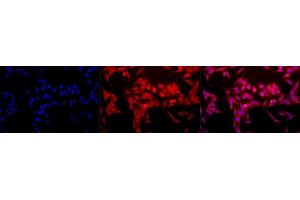 Immunocytochemistry/Immunofluorescence analysis using Rabbit Anti-HO-1 Polyclonal Antibody (ABIN361673 and ABIN361674).