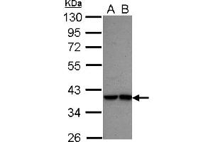 Western Blotting (WB) image for anti-Interferon Regulatory Factor 9 (IRF9) (AA 171-393) antibody (ABIN1498905) (IRF9 抗体  (AA 171-393))