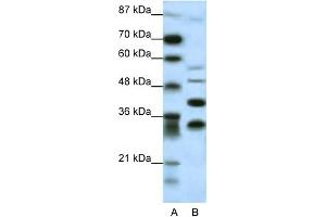 WB Suggested Anti-GFI1 Antibody Titration: 0. (GFI1 抗体  (N-Term))