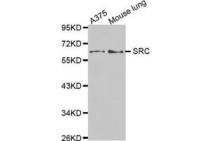 Western Blotting (WB) image for anti-Proto-oncogene tyrosine-protein kinase Src (Src) (AA 410-536) antibody (ABIN1682877) (Src 抗体  (AA 410-536))
