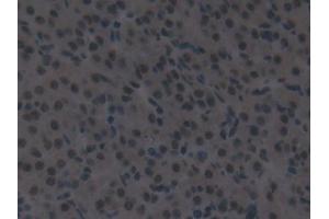 Detection of IRF2 in Mouse Ovary Tissue using Polyclonal Antibody to Interferon Regulatory Factor 2 (IRF2) (IRF2 抗体  (AA 1-349))