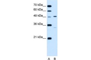 Western Blotting (WB) image for anti-Carbohydrate (Keratan Sulfate Gal-6) Sulfotransferase 1 (CHST1) antibody (ABIN2462855) (CHST1 抗体)