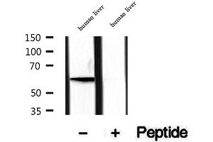 Western blot analysis of extracts of human liver tissue, using PIP5K1A antibody. (PIP5K1A 抗体  (N-Term))
