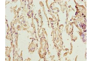 Immunohistochemistry of paraffin-embedded human lung tissue using ABIN7173119 at dilution of 1:100 (TMEM19 抗体  (AA 105-217))