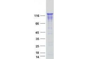WDHD1 Protein (Transcript Variant 1) (Myc-DYKDDDDK Tag)