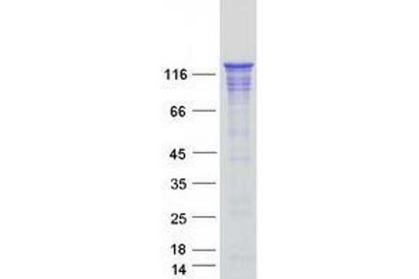 WDHD1 Protein (Transcript Variant 1) (Myc-DYKDDDDK Tag)