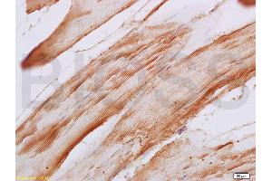 Formalin-fixed and paraffin embedded rat skeletal muscle labeled with Anti-F-Actin Polyclonal Antibody, Unconjugated (ABIN731498) at 1:200, followed by conjugation to the secondary antibody and DAB staining (F-Actin 抗体  (AA 1-50))