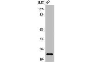 Western Blot analysis of 293 cells using Rab 35 Polyclonal Antibody