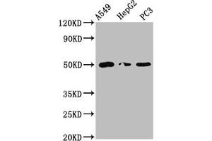 Western Blot Positive WB detected in: A549 whole cell lysate, HepG2 whole cell lysate, PC-3 whole cell lysate All lanes: IFT52 antibody at 5. (IFT52 抗体  (AA 325-434))