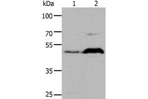 Western Blot analysis of HepG2 cell and Mouse brain tissue using HTR1A Polyclonal Antibody at dilution of 1:1000 (Serotonin Receptor 1A 抗体)