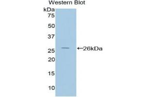 Western blot analysis of the recombinant protein. (PICK1 抗体  (AA 24-229))
