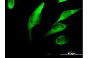 Immunofluorescence of purified MaxPab antibody to FKBP4 on HeLa cell.