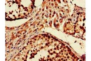 IHC image of ABIN7151093 diluted at 1:600 and staining in paraffin-embedded human testis tissue performed on a Leica BondTM system. (Parkin 抗体  (AA 1-465))
