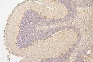 IHC analysis of SEMA3B using anti-SEMA3B antibody (ABIN6719617).