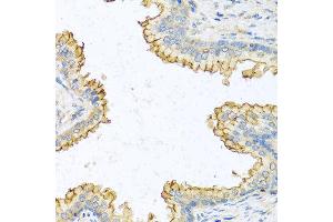 Immunohistochemistry of paraffin-embedded human prostate using RNASE13 antibody at dilution of 1:100 (40x lens). (RNASE13 抗体)