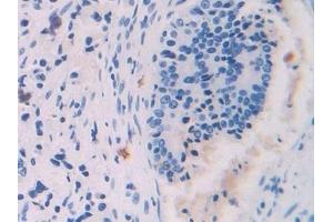 Immunohistochemistry (IHC) image for anti-Platelet Factor 4 (PF4) (AA 31-101) antibody (ABIN7431254)