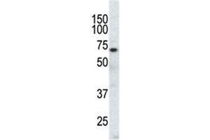 Western blot analysis of EphA3 antibody and CHO cell lysate. (EPH Receptor A3 抗体  (AA 896-928))