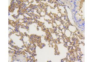 Immunohistochemistry of paraffin-embedded mouse lung using ARRB1 antibody (ABIN4903044) at dilution of 1:100 (40x lens).
